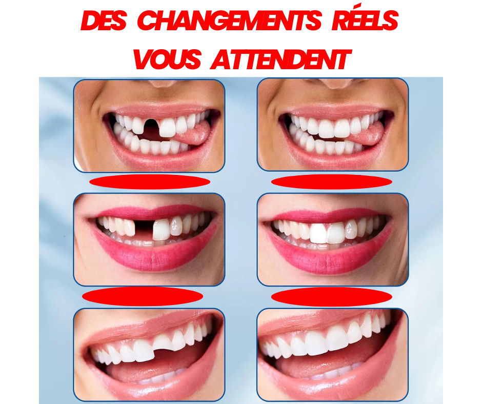 🦷 Gel Dentaire Moulable : Retrouvez Votre Sourire en Quelques Minutes ! Votre Sourire Mérite d'Être Complet