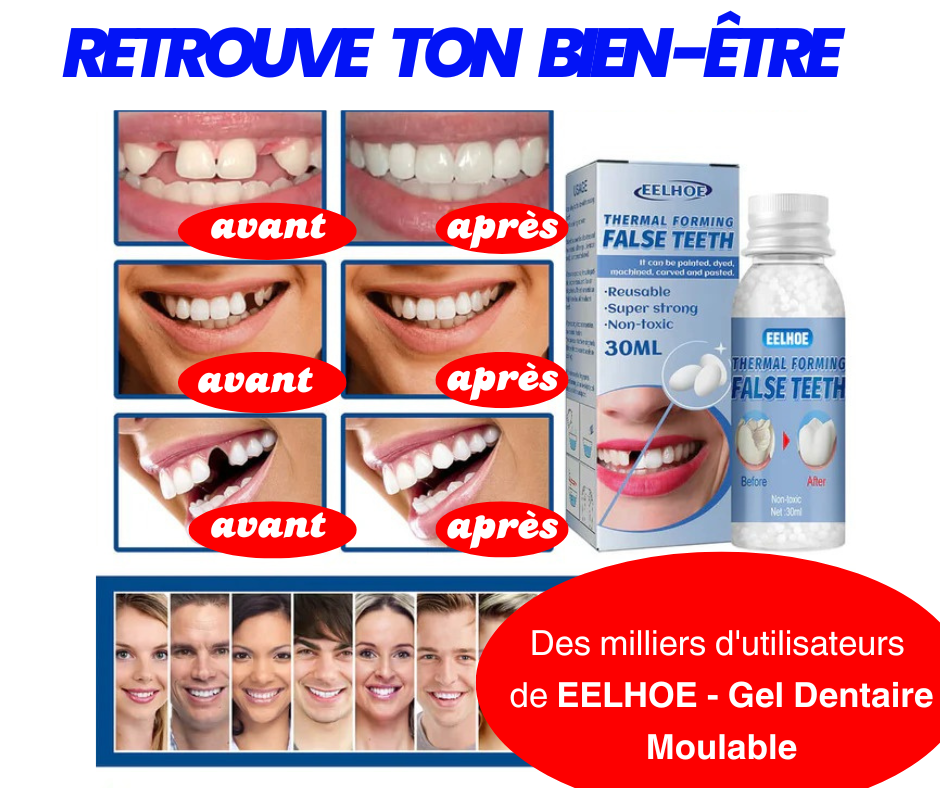 🦷 Gel Dentaire Moulable : Retrouvez Votre Sourire en Quelques Minutes ! Votre Sourire Mérite d'Être Complet